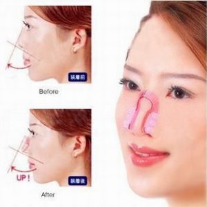 Produk Nose Up Mancungkan Hidung