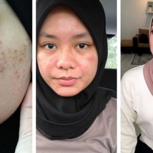 Syafiqah Aina Dulu Gemuk Dan Berjerawat Kini Kurus Dan Cantik